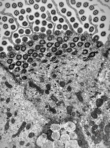 M,22y. | normal bronchial epithelium M,22y. | normal bronchial epithelium